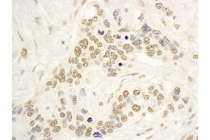 anti-Nucleolar Protein 8 (NOL8) (AA 1117-1167) antibody