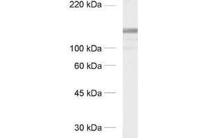 dilution: 1 : 1000, sample: crude synaptic membranes fraction of rat brain (LP1)