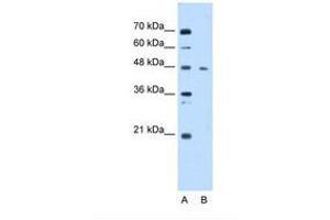 Image no. 1 for anti-Enolase 3 (Beta, Muscle) (ENO3) (AA 21-70) antibody (ABIN6738428) (ENO3 anticorps  (AA 21-70))