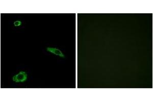 Immunofluorescence analysis of MCF7 cells, using ACTHR Antibody. (MC2R anticorps  (AA 248-297))