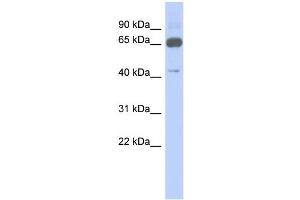 WB Suggested Anti-ZNF446 Antibody Titration:  0. (ZNF446 anticorps  (N-Term))