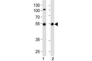 Western blot analysis of lysate from (1) SH-SY5Y cell line and (2) human brain tissue lysate using Parkin antibody at 1:1000.