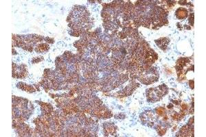 Formalin-fixed, paraffin-embedded human parathyroid stained with PTH antibody (PTH/1174). (PTH anticorps  (AA 32-115))