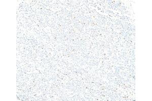 Immunohistochemistry (IHC) image for anti-Forkhead Box P3 (FOXP3) (AA 52-276) antibody (ABIN7795820)