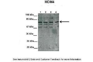 Lanes:  1. (MDM4-binding Protein anticorps  (N-Term))