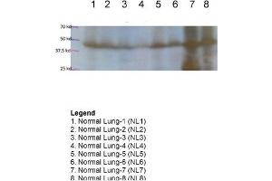Sample Type: Human lung tissue protein extractsPrimary Dilution: 1:1000Secondary (Anti-Rabbit HRP sc-2004) Dilution: 1:1000 (FOXA2 anticorps  (Middle Region))