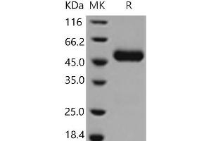 Western Blotting (WB) image for Ciliary Neurotrophic Factor Receptor (CNTFR) (Active) protein (His tag) (ABIN7321238)