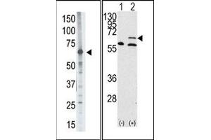 Image no. 1 for anti-Matrix Metallopeptidase 14 (Membrane-inserted) (MMP14) (N-Term) antibody (ABIN358687)