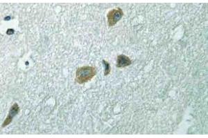 Immunohistochemistry (IHC) analyzes of ILK antibody in paraffin-embedded human brain tissue. (ILK anticorps)