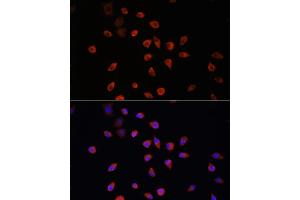 Immunofluorescence analysis of L929 cells using IFT88 antibody (ABIN6131798, ABIN6142226, ABIN6142227 and ABIN6216899) at dilution of 1:100.