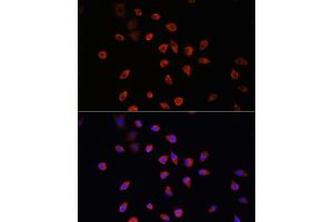 Immunofluorescence analysis of L929 cells using IFT88 antibody (ABIN6131798, ABIN6142226, ABIN6142227 and ABIN6216899) at dilution of 1:100. (IFT88 anticorps  (AA 534-833))
