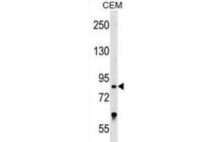 Western Blotting (WB) image for anti-Transcription Factor 25 (Basic Helix-Loop-Helix) (TCF25) antibody (ABIN2999343) (TCF25 anticorps)