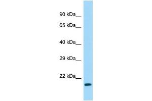 Host:  Rabbit  Target Name:  Naa40  Sample Type:  Mouse Stomach lysates  Antibody Dilution:  1. (NAA40 anticorps  (C-Term))