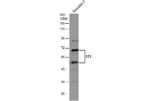WB Image Whole cell extract (30 μg) was separated by 10% SDS-PAGE, and the membrane was blotted with ST2 antibody [N1C1] , diluted at 1:500. (IL1RL1 anticorps)