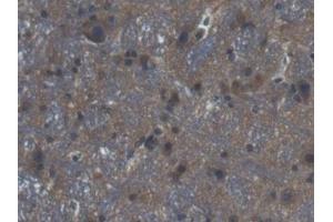 Detection of GLRX3 in Mouse Cerebrum Tissue using Polyclonal Antibody to Glutaredoxin 3 (GLRX3)
