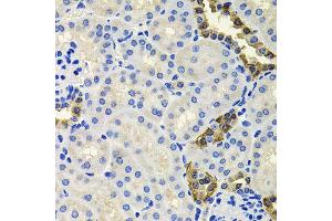 Immunohistochemistry of paraffin-embedded mouse kidney using CALB2 antibody (ABIN6003539) at dilution of 1/100 (40x lens). (Calretinin anticorps)