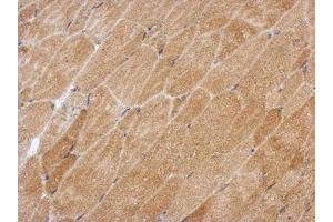 anti-GPI Anchor Attachment Protein 1 (GPAA1) (AA 201-539) antibody