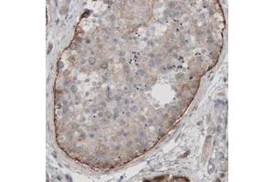 Immunohistochemical staining (Formalin-fixed paraffin-embedded sections) of human testis with LAMA1 monoclonal antibody, clone CL3087  shows moderate immunoreactivity in basement membrane of seminiferous tubules. (Laminin alpha 1 anticorps)