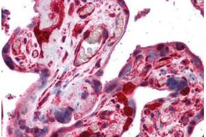 Human Placenta: Formalin-Fixed, Paraffin-Embedded (FFPE)