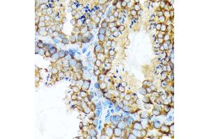 Immunohistochemistry of paraffin-embedded mouse testis using STIP1 Rabbit mAb (ABIN1512566, ABIN3020619, ABIN3020620 and ABIN7101303) at dilution of 1:100 (40x lens). (STIP1 anticorps)