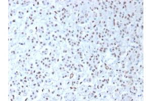 ABIN6383831 to WT1 was successfully used to stain nuclei in human mesothelioma and rat testis sections.