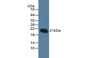 Detection of MGMT in Human Jurkat Cells using Polyclonal Antibody to O-6-Methylguanine DNA Methyltransferase (MGMT) (MGMT anticorps  (AA 1-207))