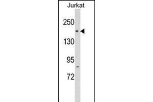 RP1 Antibody (N-term) (ABIN1539273 and ABIN2848774) western blot analysis in Jurkat cell line lysates (35 μg/lane). (RPAP1 anticorps  (N-Term))