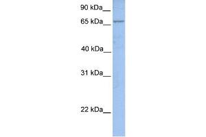 WB Suggested Anti-ACSL1 Antibody Titration:  0. (ACSL1 anticorps  (N-Term))