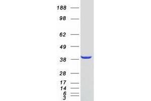 Validation with Western Blot