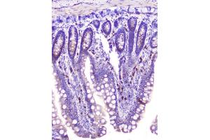IHC analysis of RASAL1 using anti-RASAL1 antibody (ABIN6719367). (RASAL1 anticorps  (AA 721-798))