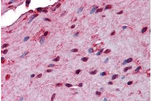 Human Small Intestine, Muscularis Propria: Formalin-Fixed, Paraffin-Embedded (FFPE) (STIP1 anticorps  (AA 1-544))