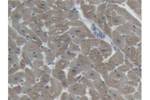 Detection of cTnI in Porcine Heart Tissue using Polyclonal Antibody to Cardiac Troponin I (cTnI)