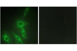 Immunofluorescence (IF) image for anti-Ral GTPase Activating Protein, alpha Subunit 2 (Catalytic) (RALGAPA2) (AA 641-690) antibody (ABIN2889865) (RALGAPA2 anticorps  (AA 641-690))