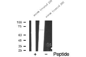 Western blot analysis of FKHR expression in serum treated 293 whole cell lysates,The lane on the left is treated with the antigen-specific peptide. (FOXO1 anticorps  (Internal Region))