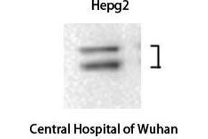 Western Blot (WB) analysis: Please contact us for more details.