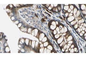 ABIN6272259 at 1/100 staining Rat colon tissue by IHC-P. (BTBD6 anticorps  (Internal Region))