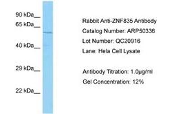 ZNF835 anticorps  (AA 320-369)