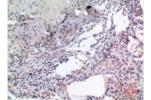 Immunohistochemistry (IHC) analysis of paraffin-embedded Human Lung, antibody was diluted at 1:100.