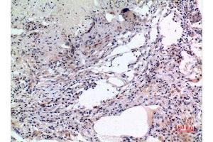 Immunohistochemistry (IHC) analysis of paraffin-embedded Human Lung, antibody was diluted at 1:100. (MCM7 anticorps  (Internal Region))