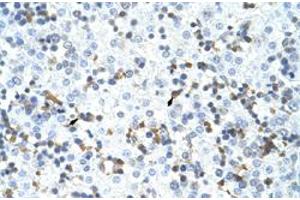 Immunohistochemical staining (Formalin-fixed paraffin-embedded sections) of human liver with CPSF3 polyclonal antibody  at 4-8 ug/mL working concentration. (CPSF3 anticorps  (C-Term))