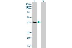 Western Blot analysis of RNF14 expression in transfected 293T cell line by RNF14 monoclonal antibody (M01), clone 4G9. (RNF14 anticorps  (AA 217-316))