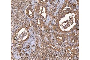 IHC analysis of HSD11B2 using anti-HSD11B2 antibody (ABIN7602698).