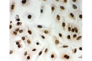 ICC testing of Lamin A antibody and A549 cells (Lamin A/C anticorps  (AA 481-646))