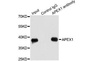 Immunoprecipitation analysis of 200ug extracts of HeLa cells using 1ug APEX1 antibody.