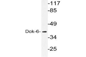 Western blot (WB) analysis of Dok-6 pAb in extracts from COLO205 cells. (DOK6 anticorps)