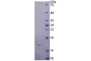 Rabbit Detection antibody from the kit in WB with Positive Control:  Sample Human Kidney lysate. (FABP4 Kit ELISA)