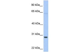 WB Suggested Anti-HPRT1 Antibody Titration:  0. (HPRT1 anticorps  (Middle Region))