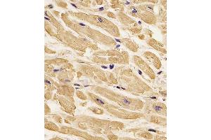 (ABIN658990 and ABIN2838035) staining ACTB in human heart tissue sections by Immunohistochemistry (IHC-P - paraformaldehyde-fixed, paraffin-embedded sections).