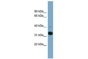 METAP1 antibody used at 1 ug/ml to detect target protein. (METAP1 anticorps  (N-Term))