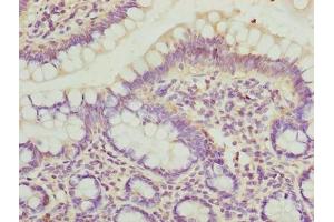 Immunohistochemistry of paraffin-embedded human small intestine tissue using ABIN7150894 at dilution of 1:100 (DYNLRB1 anticorps  (AA 3-96))